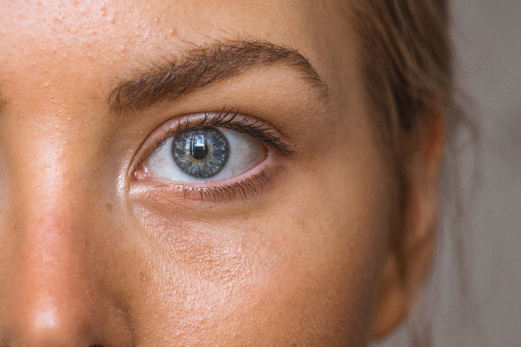 Natural Ways to Treat Warts Natural Ways to Treat Warts